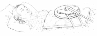 Расположение индуктора-диска при индуктотермии