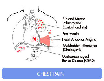 right side chest pain underarm