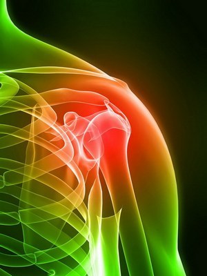 Лечение периартрита плечевого сустава – симптомы однозначны