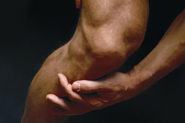 Мениск коленного сустава - лечение мениска коленного сустава ...