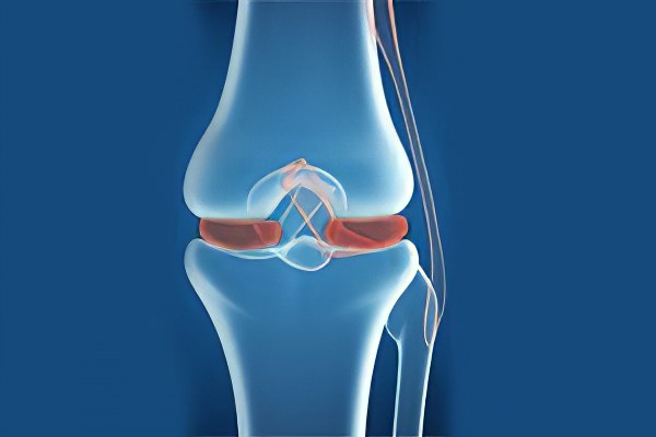 Воспаление мениска коленного сустава – причины, симптомы ...
