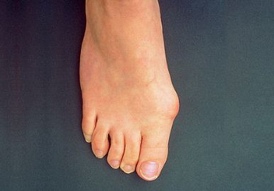 Болит палец на ноге к какому врачу обратиться