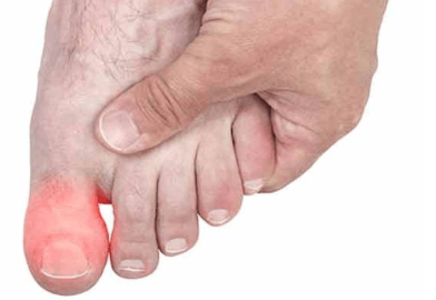 Болит палец на ноге к какому врачу обратиться