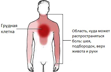 Симптомы растяжения грудных мышц