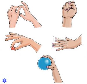 Упражнения для восстановления работоспособности пальцев руки после вывиха