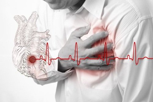 Онемение левой руки – предвестник заболеваний сердца