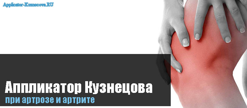 Аппликатор Кузнецова при артрозе и артрите