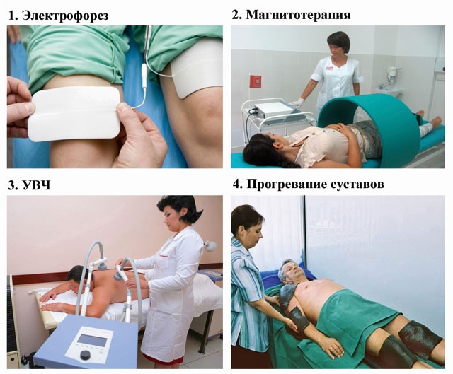 Боль после электрофореза. Физио терапия электрофорез. УВЧ-терапия коленного сустава. Физиолечение УВЧ. Физиотерапия электрофорез УВЧ.