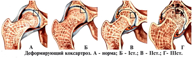 Степени ДОА