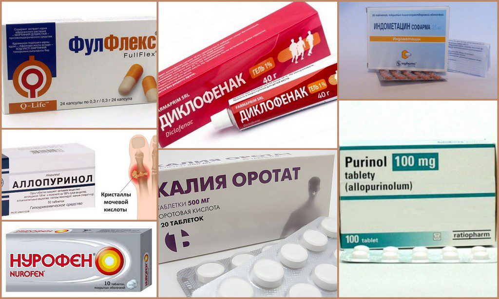 Примеры медикаментов для лечение подагры