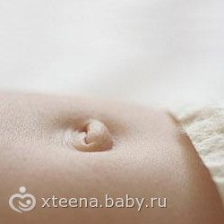 Пупочная грыжа у новорождённых
