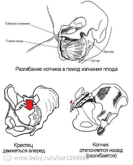 Почему болит копчик после родов?