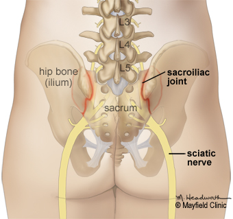 Sacroiliac joint anatomy