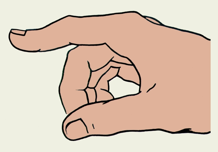 Рис. 6. Схематическое изображение двойной контрактуры указательного пальца правой кисти (сгибание в проксимальном межфаланговом суставе и разгибание — в дистальном) при повреждении сухожилия разгибателя пальца с сохранением боковых тяжей (функции червеобразных мышц)
