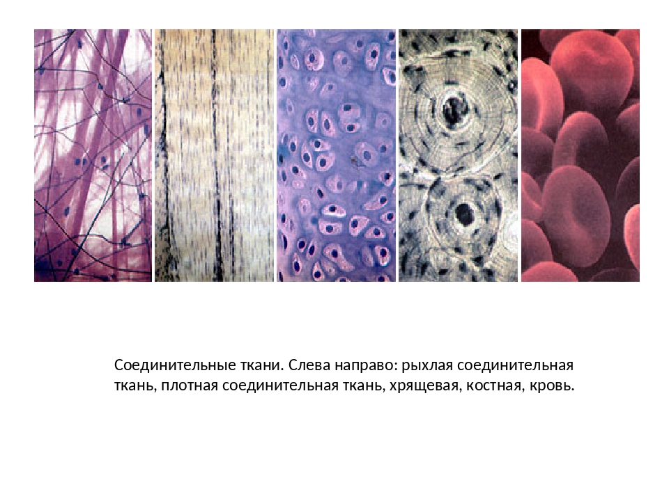 Смешанные заболевания соединительной. Межклеточный Матрикс соединительной ткани. Соединительная ткань жировая хрящевая костная. Соединительная ткань кровь хрящевая. Строение межклеточного матрикса соединительной ткани.