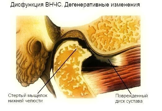 ВНЧС: Как изменения в области одного органа вызывает каскад реакций во всем теле