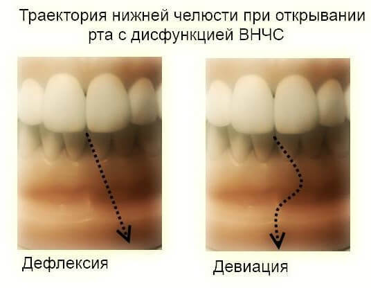 ВНЧС: Как изменения в области одного органа вызывает каскад реакций во всем теле