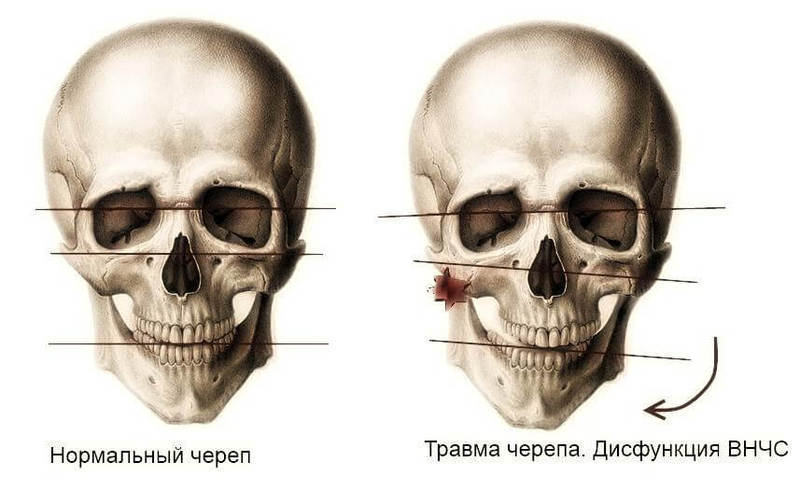 ВНЧС: Как изменения в области одного органа вызывает каскад реакций во всем теле