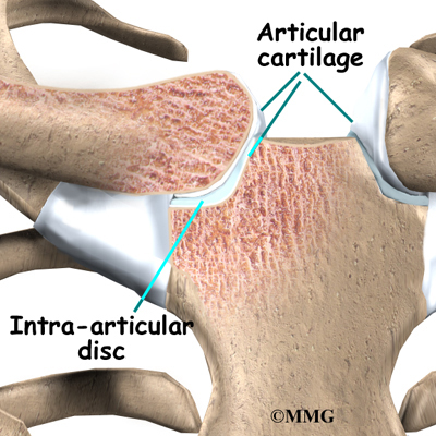 Sternoclavicular Joint Problems