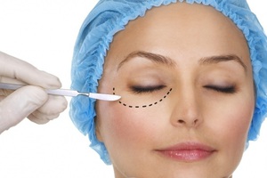 Хирургическое удаление глазной грыжи