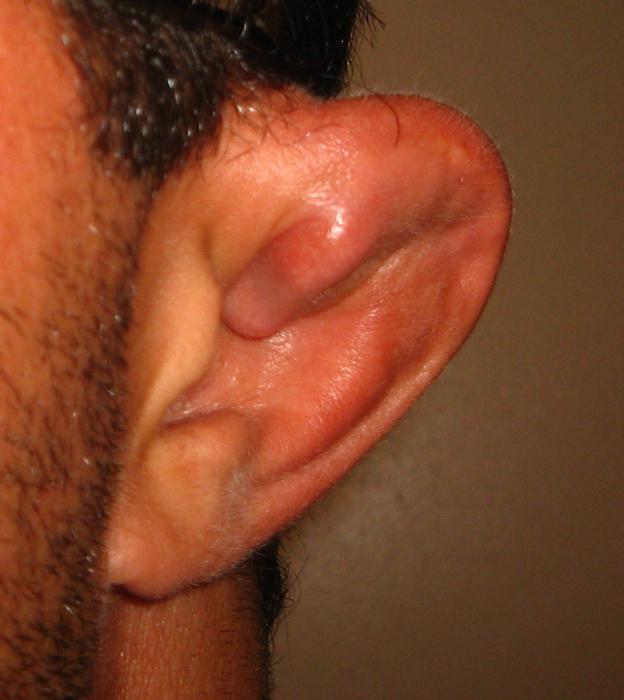 Как можно сломать ухо