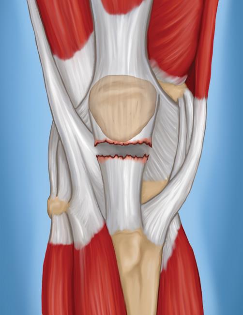 мышцы действующие на коленный сустав