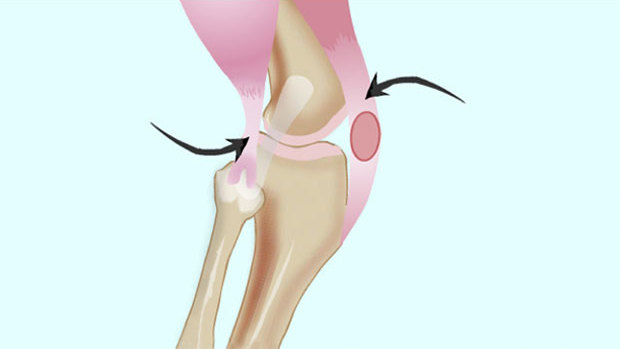 сухожилия коленного сустава