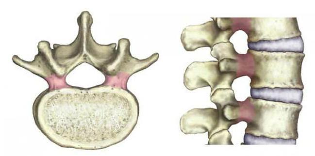 Как образуются межпозвоночные отверстия 
