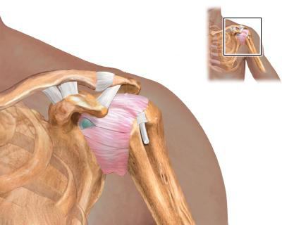 анатомия плечевого сустава мрт