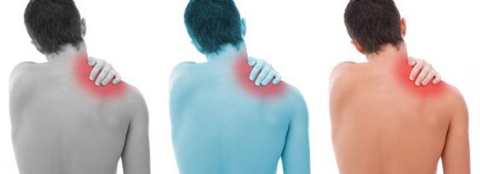 остеохондроз шейно плечевого сустава симптомы