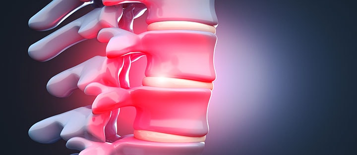 Проблемы с позвоночником
