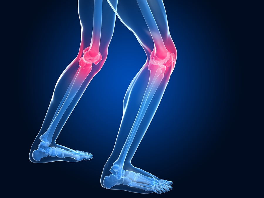 Артротомия коленного сустава