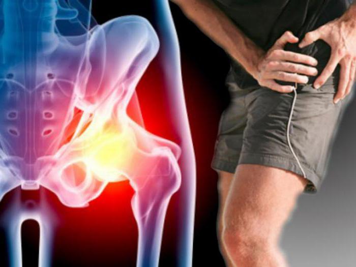 лечение лазером артроза коленного сустава 