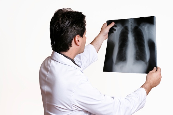 врач изучает рентгеновский снимок 