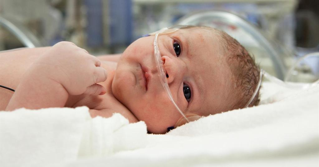 гипоплазия легких у новорожденных
