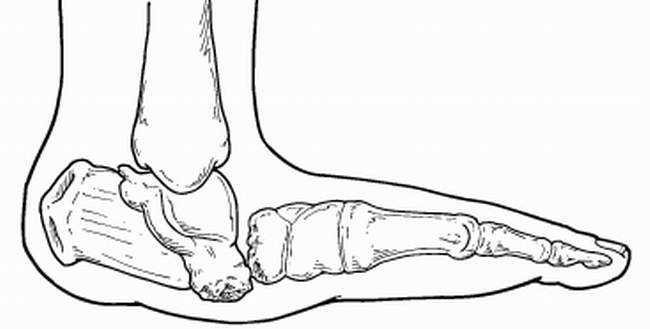 Болезни суставов ног стопы названия
