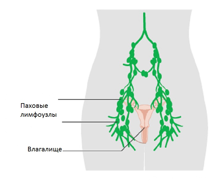 Схема паховых лимфоузлов