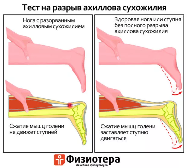 Примеры возможных упражнений