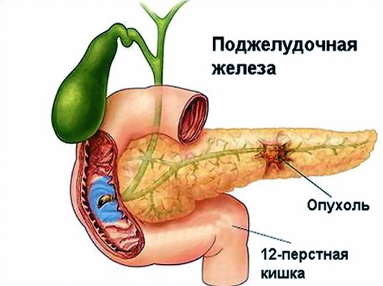 Причины боли в левом боку живота у женщин и мужчин. Характер боли и лечение