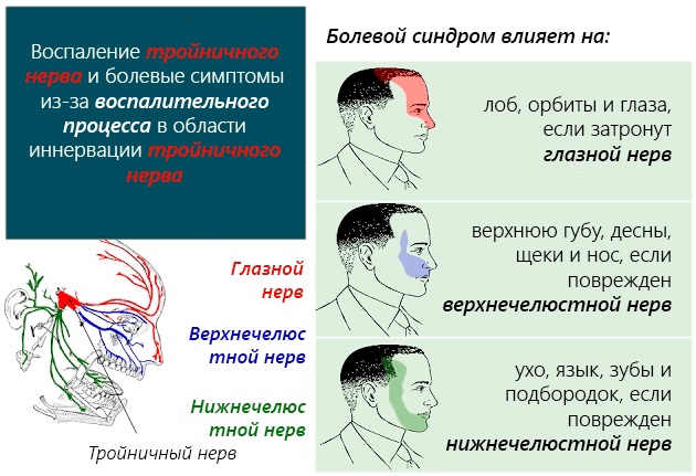 Тройничный нерв. Воспаление, симптомы, анатомия, где находится, схема лечения