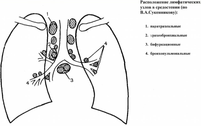 Где расположены лимфоузлы у человека на голове фото признаки