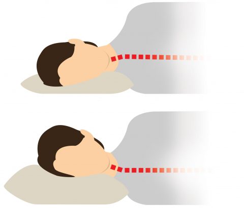 neck pain from sleeping