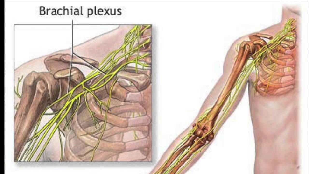 Сколько лечится нерв. Плексит неврит плечевого нерва. Плексит плечевого сплетения реабилитация. Неврит (плексит) плечевого сплетения..