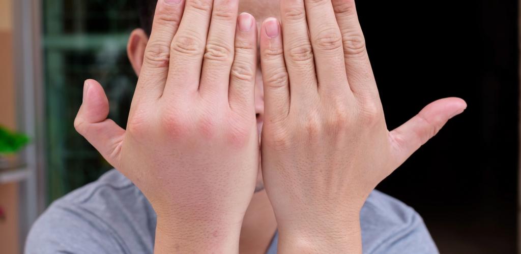 Почему отекают пальцы на руках: причины, возможные заболевания, лечение