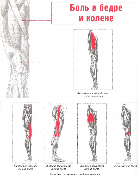Болит нога от бедра. Тянет ногу в бедре сбоку. Болит мышца бедра сбоку. Боль передней бедренной мышцы бедра. Боль в бедре с внешней стороны.