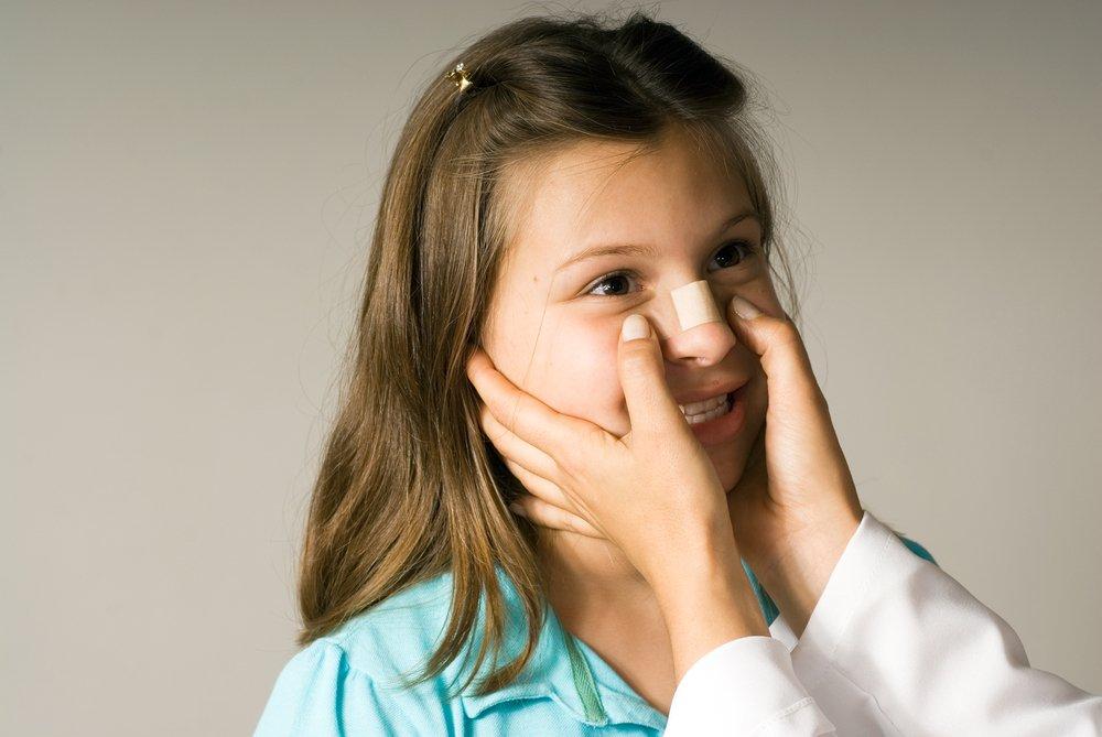 Диагностика перелома носа у детей