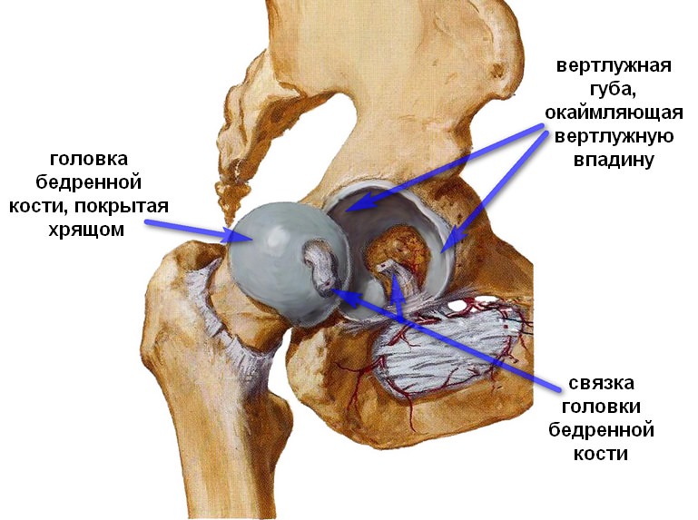 Вывих тазобедренного сустава