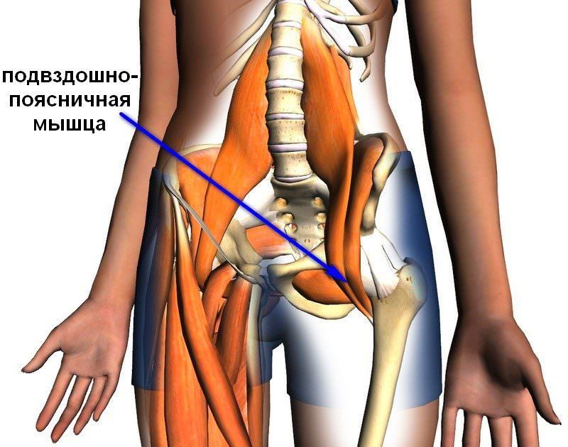 Синдром подвздошно-поясничной мышцы