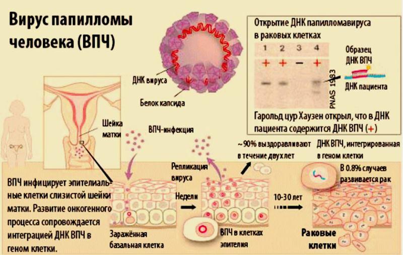 Вирус папилломы человека