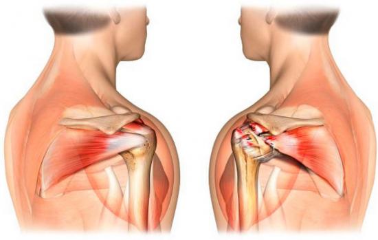 связки и мышцы плеча